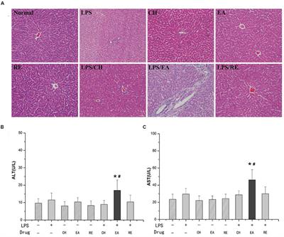 Metabolomic Study on Idiosyncratic Liver Injury Induced by Different Extracts of Polygonum multiflorum in Rats Integrated with Pattern Recognition and Enriched Pathways Analysis